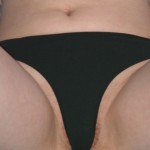 Amateur Pictures